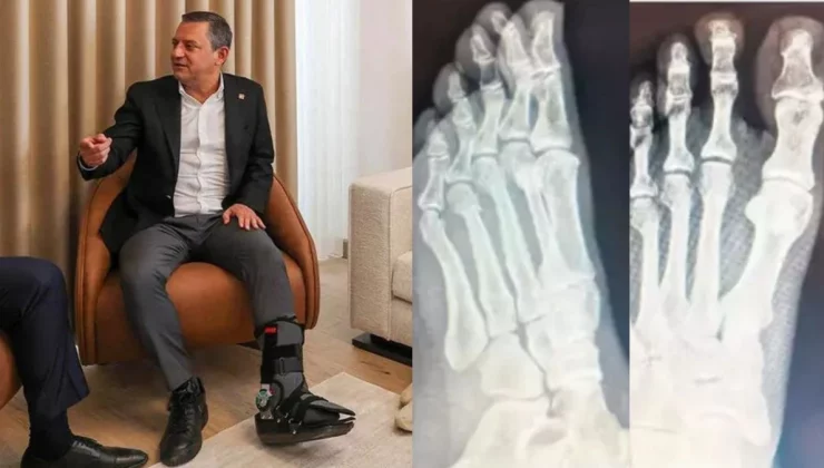 Özgür Özel’in ayağına ne oldu? CHP lideri Özgür Özel’in sağlık durumu nasıl?